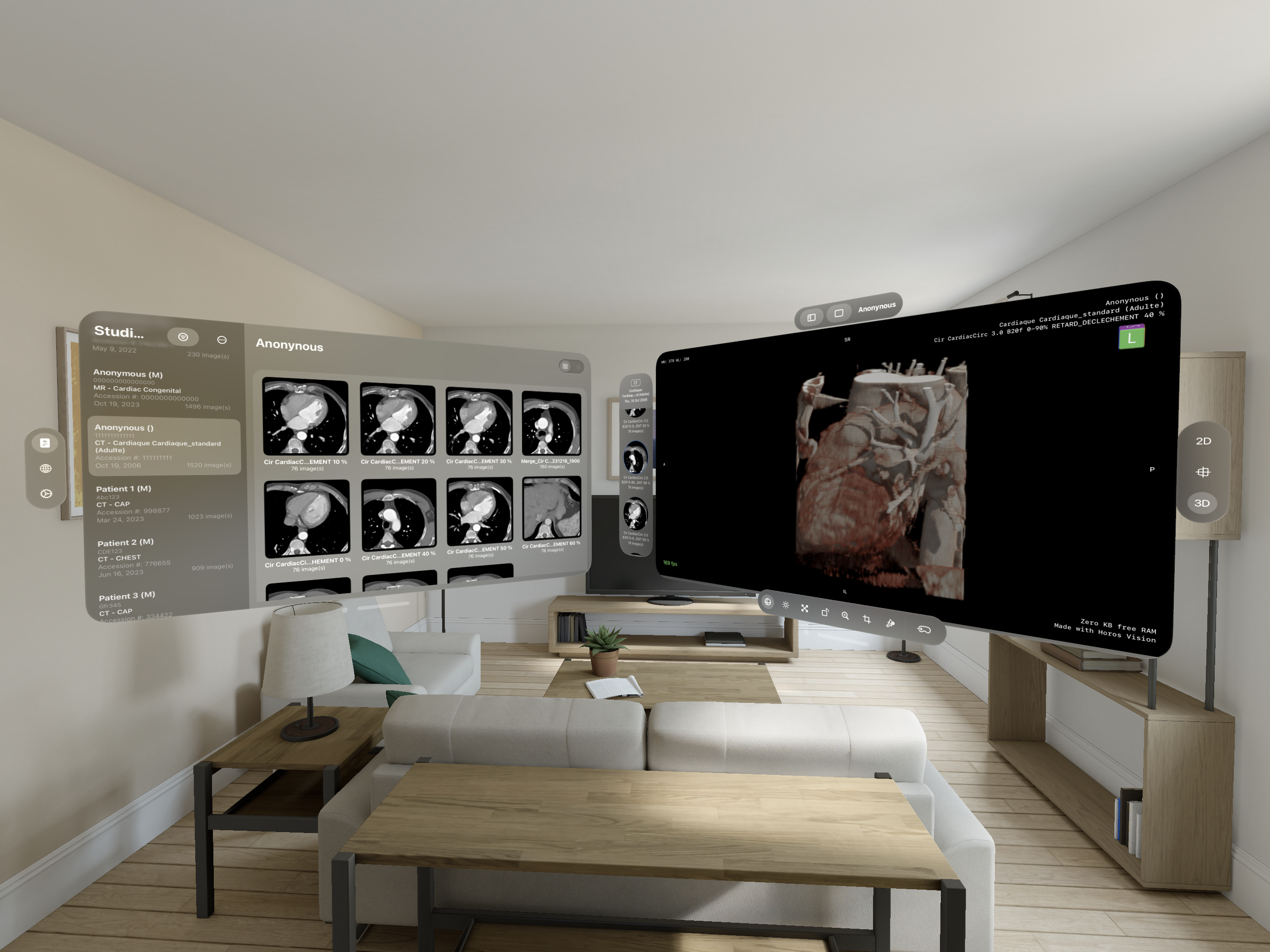 Falcon Vue immersive medical imaging workspace